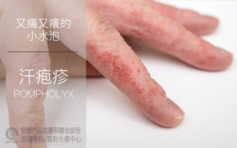新竹安慎醫美皮膚科診所/電波音波拉提/玻尿酸